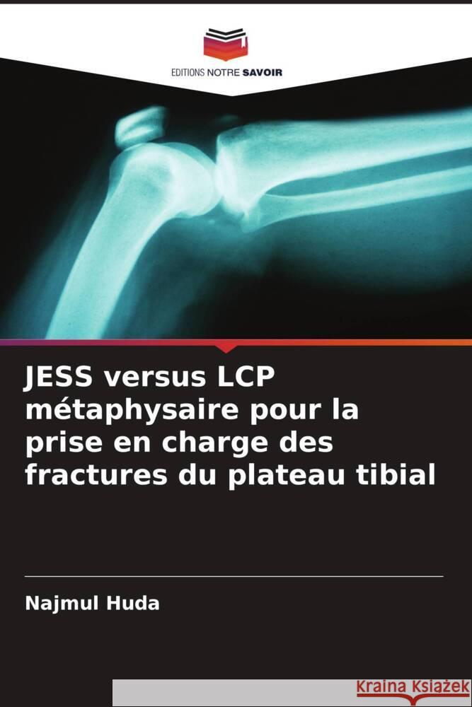 JESS versus LCP métaphysaire pour la prise en charge des fractures du plateau tibial Huda, Najmul 9786205457726 Editions Notre Savoir - książka