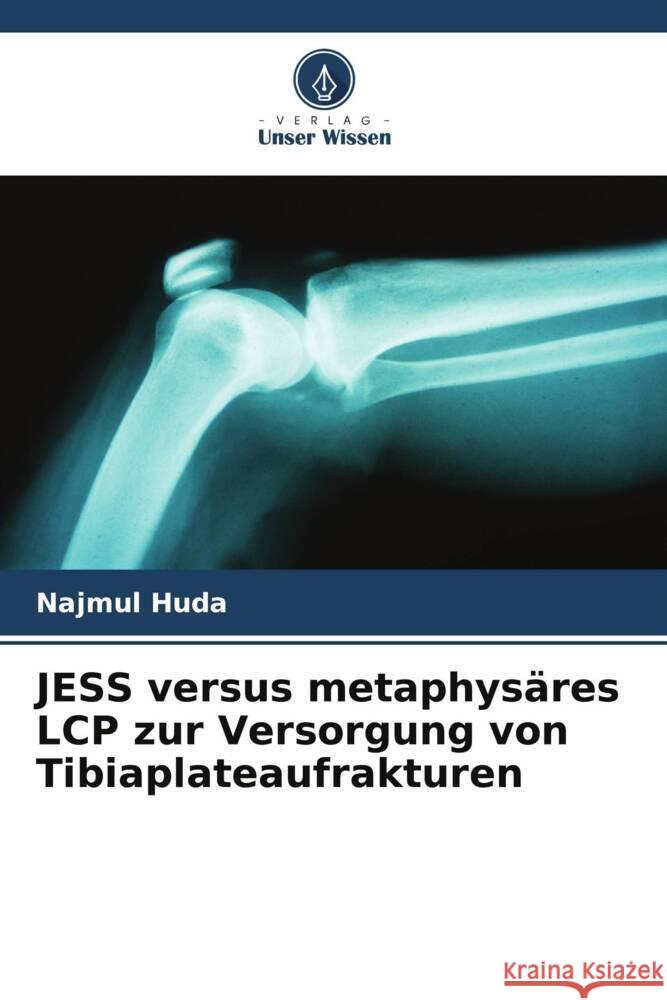 JESS versus metaphysäres LCP zur Versorgung von Tibiaplateaufrakturen Huda, Najmul 9786205457733 Verlag Unser Wissen - książka