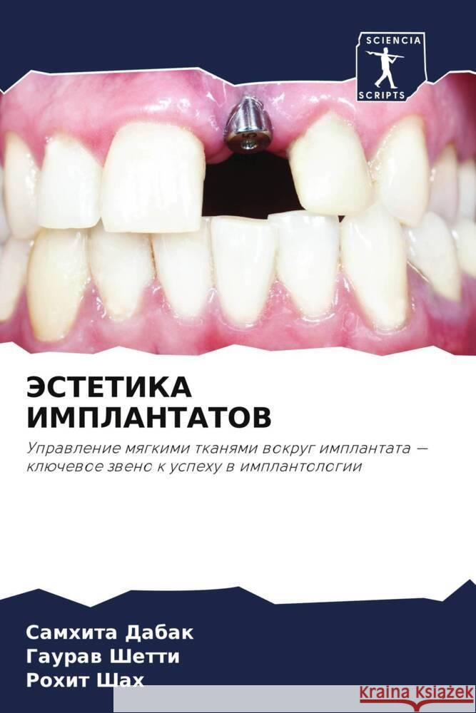 JeSTETIKA IMPLANTATOV Dabak, Samhita, Shetti, Gauraw, Shah, Rohit 9786204560939 Sciencia Scripts - książka