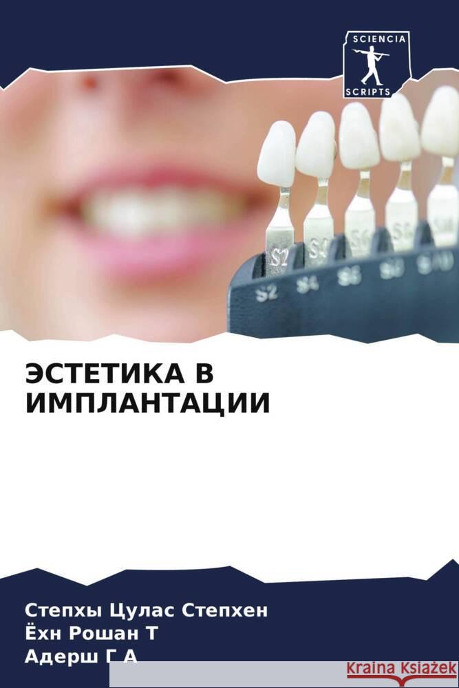 JeSTETIKA V IMPLANTACII Stephen, Stephy Culas, Roshan T, John, G A, Adersh 9786208190323 Sciencia Scripts - książka