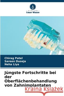 Jüngste Fortschritte bei der Oberflächenbehandlung von Zahnimplantaten Patel, Chirag, Duseja, Sareen, Liya, Neha 9786208752484 Verlag Unser Wissen - książka