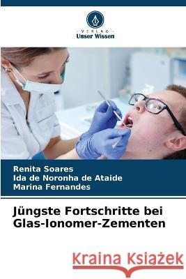 Jüngste Fortschritte bei Glas-Ionomer-Zementen Soares, Renita 9786205302149 Verlag Unser Wissen - książka