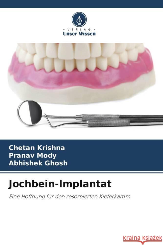 Jochbein-Implantat Krishna, Chetan, Mody, Pranav, Ghosh, Abhishek 9786206345657 Verlag Unser Wissen - książka