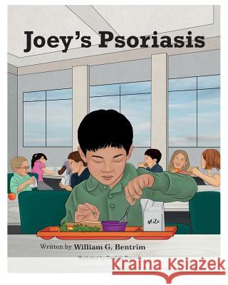Joey's Psoriasis: Explaining Psoriasis To Children William G Bentrim, Danijela Popovic 9781985344242 Createspace Independent Publishing Platform - książka