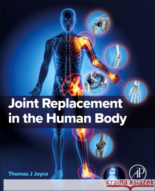 Joint Replacement in the Human Body Thomas J. Joyce 9780443248689 Elsevier Science Publishing Co Inc - książka