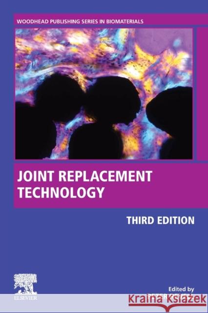 Joint Replacement Technology Peter A. Revell 9780128210826 Woodhead Publishing - książka