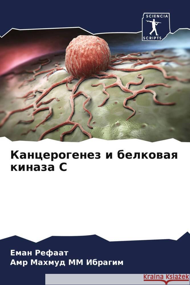 Kancerogenez i belkowaq kinaza S Refaat, Eman, MM Ibragim, Amr Mahmud 9786205452769 Sciencia Scripts - książka