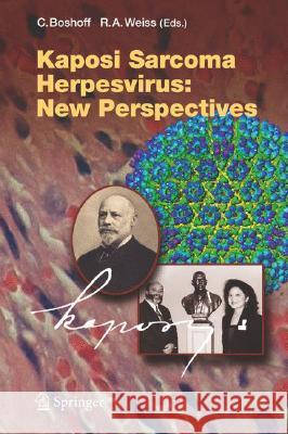Kaposi Sarcoma Herpesvirus: New Perspectives Chris Boshoff, R.A. Weiss 9783540343431 Springer-Verlag Berlin and Heidelberg GmbH &  - książka