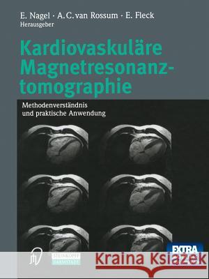 Kardiovaskuläre Magnetresonanztomographie: Methodenverständnis Und Praktische Anwendung Nagel, E. 9783642632914 Steinkopff-Verlag Darmstadt - książka