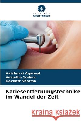 Kariesentfernungstechniken im Wandel der Zeit Vaishnavi Agarwal Vasudha Sodani Devdatt Sharma 9786207529247 Verlag Unser Wissen - książka