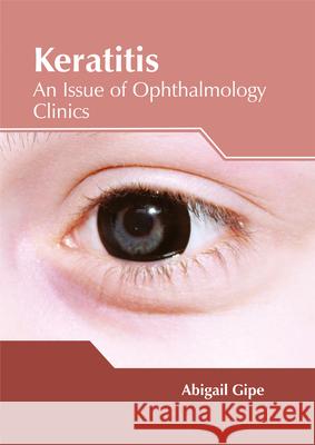 Keratitis: An Issue of Ophthalmology Clinics Abigail Gipe 9781632425096 Foster Academics - książka
