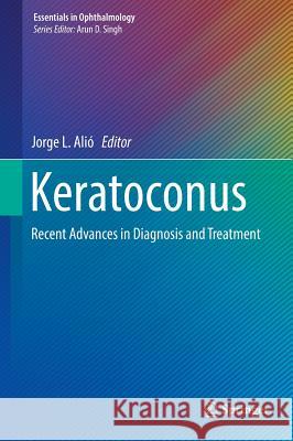 Keratoconus: Recent Advances in Diagnosis and Treatment Alió, Jorge L. 9783319438795 Springer - książka