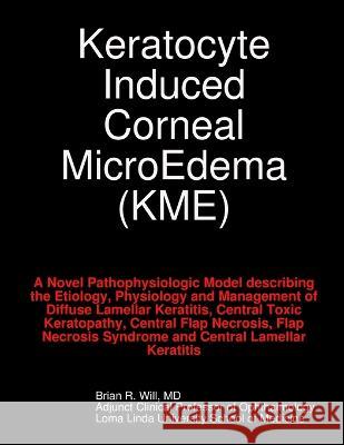 Keratocyte Induced Corneal MicroEdema Brian Will 9780578017297 Visionary Publishing - książka