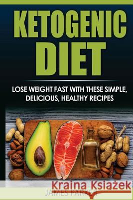 Ketogenic Diet: Lose weight Fast with these simple, delicious, healthy recipes Parker, James 9781974032167 Createspace Independent Publishing Platform - książka