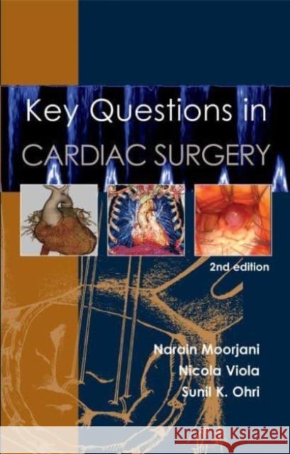 Key Questions in Cardiac Surgery  9781913755409 TFM Publishing Ltd - książka