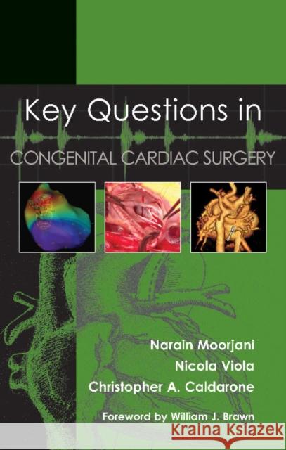 Key Questions in Congenital Cardiac Surgery Moorjani 9781903378946 Tfm Publishing - książka