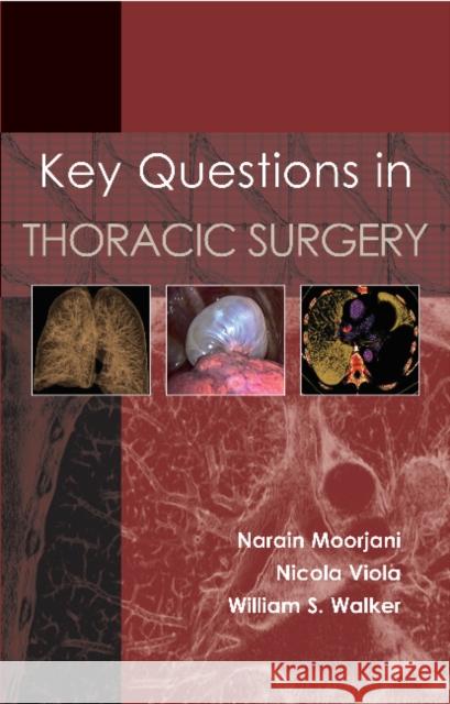 Key Questions in Thoracic Surgery Moorjani 9781903378861 Tfm Publishing - książka