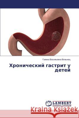 Khronicheskiy Gastrit U Detey Volynets Galina Vasil'evna 9783659354731 LAP Lambert Academic Publishing - książka