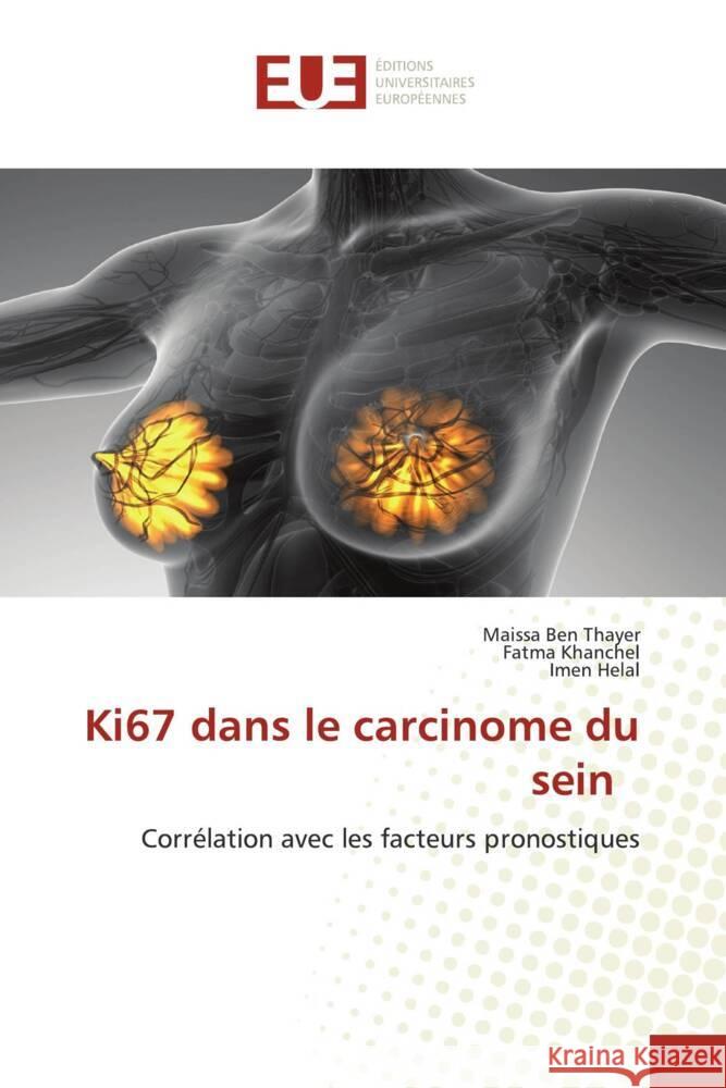 Ki67 dans le carcinome du sein Ben Thayer, Maissa, khanchel, Fatma, Helal, Imen 9786203441680 Éditions universitaires européennes - książka