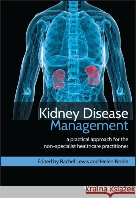 Kidney Disease Management: A Practical Approach for Non-Specialist Healthcare Practitioner Lewis, Rachel 9780470670613  - książka