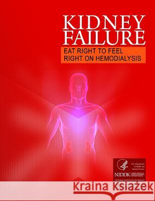 Kidney Failure Eat Right to Feel Right on Hemodialysis U. S. Department of Health and Services 9781494871659 Createspace - książka