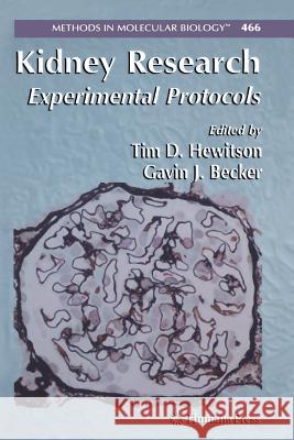 Kidney Research: Experimental Protocols Hewitson, Tim D. 9781493956401 Humana Press - książka