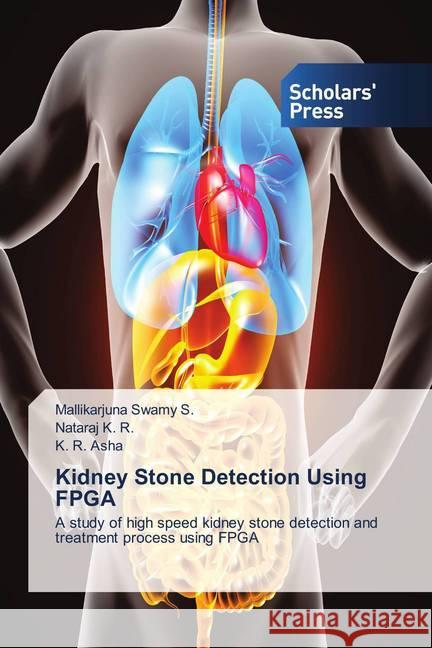 Kidney Stone Detection Using FPGA : A study of high speed kidney stone detection and treatment process using FPGA Swamy S., Mallikarjuna; K. R., Nataraj; Asha, K. R. 9786202313070 Scholar's Press - książka