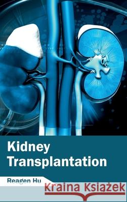 Kidney Transplantation Reagen Hu 9781632412744 Hayle Medical - książka