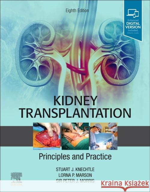 Kidney Transplantation - Principles and Practice Stuart J. Knechtle Lorna P. Marson Peter J. Morris 9780323531863 Elsevier - książka
