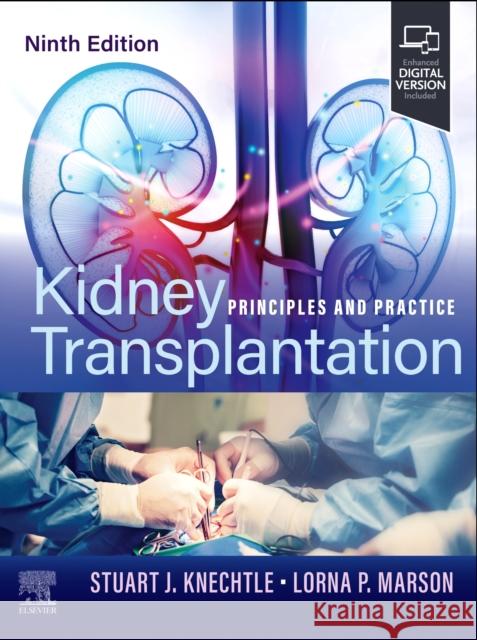 Kidney Transplantation: Principles and Practice Stuart J. Knechtle Lorna P. Marson 9780443113291 Elsevier Health Sciences - książka