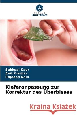 Kieferanpassung zur Korrektur des Überbisses Kaur, Sukhpal, Prashar, Anil, Kaur, Rajdeep 9786208899165 Verlag Unser Wissen - książka