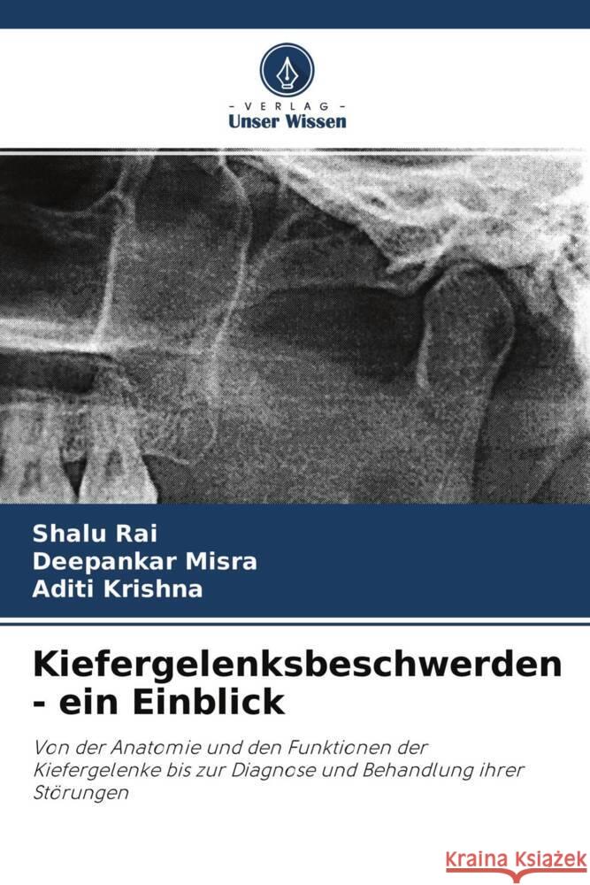 Kiefergelenksbeschwerden - ein Einblick Rai, Shalu, Misra, Deepankar, Krishna, Aditi 9786204152608 Verlag Unser Wissen - książka