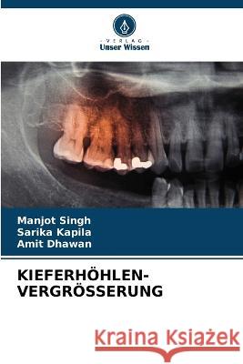Kieferhoehlen-Vergroesserung Manjot Singh Sarika Kapila Amit Dhawan 9786206228455 Verlag Unser Wissen - książka