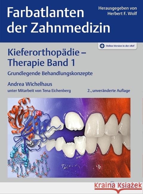 Kieferorthopädie - Therapie. Bd.1 : Grundlegende Behandlungskonzepte. Plus Online-Version in der eRef  9783132417830 Thieme, Stuttgart - książka