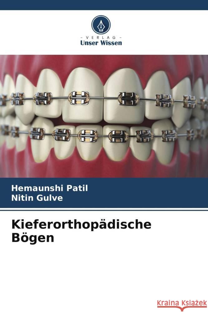 Kieferorthop?dische B?gen Hemaunshi Patil Nitin Gulve 9786208228552 Verlag Unser Wissen - książka