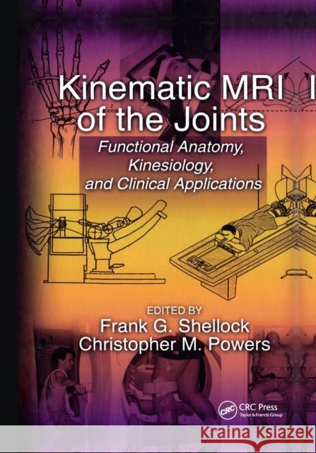 Kinematic MRI of the Joints Frank G. Shellock Christopher Powers 9780367397463 CRC Press - książka