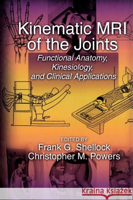 Kinematic MRI of the Joints: Functional Anatomy, Kinesiology, and Clinical Applications Shellock, Frank G. 9780849308079 CRC Press - książka