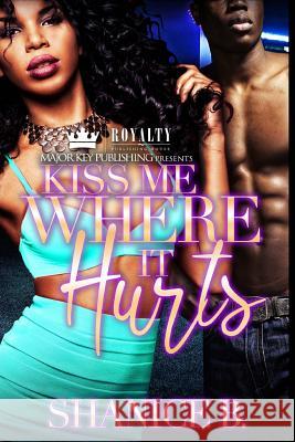 Kiss Me Where It Hurts Shanice B 9781979415729 Createspace Independent Publishing Platform - książka