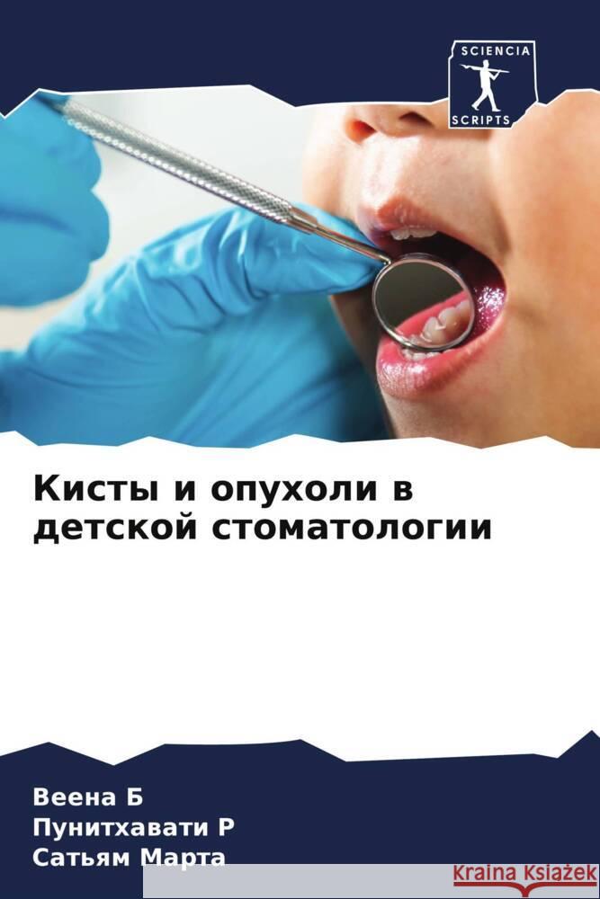 Kisty i opuholi w detskoj stomatologii B, Veena, R, Punithawati, Marta, Sat'qm 9786208220327 Sciencia Scripts - książka