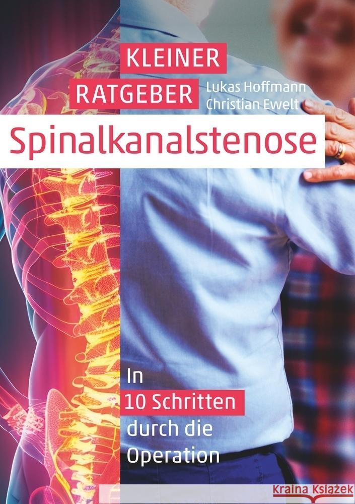 Kleiner Ratgeber Spinalkanalstenose Hoffmann, Lukas 9783759272461 via tolino media - książka