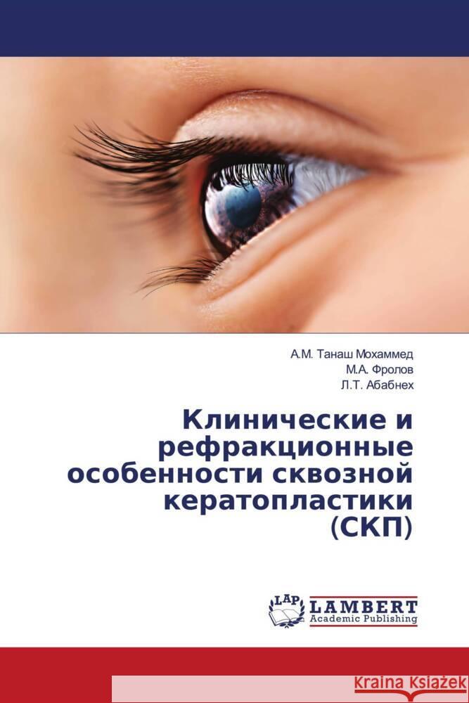 Klinicheskie i refrakcionnye osobennosti skwoznoj keratoplastiki (SKP) Tanash Mohammed, A.M., Frolow, M.A., Ababneh, L.T. 9786203409352 LAP Lambert Academic Publishing - książka