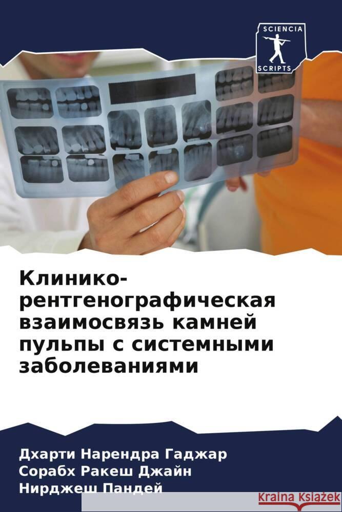 Kliniko-rentgenograficheskaq wzaimoswqz' kamnej pul'py s sistemnymi zabolewaniqmi Gadzhar, Dharti Narendra, Dzhajn, Sorabh Rakesh, Pandej, Nirdzhesh 9786208133115 Sciencia Scripts - książka