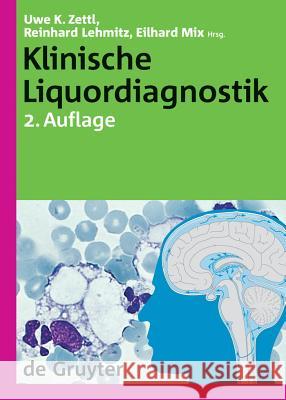 Klinische Liquordiagnostik Uwe K. Zettl, Reinhard Lehmitz, Eilhard Mix 9783110181692 De Gruyter - książka