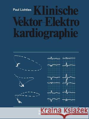 Klinische Vektor-Elektrokardiographie P. Lichtlen 9783642872013 Springer - książka