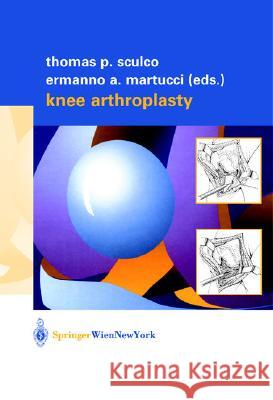Knee Arthroplasty Ermanno A. Martucci Thomas P. Sculco E. A. Martucci 9783211835319 Springer - książka