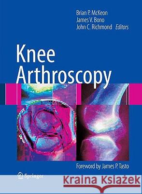 Knee Arthroscopy Brian P. McKeon James V. Bono John C. Richmond 9780387895031 Springer - książka