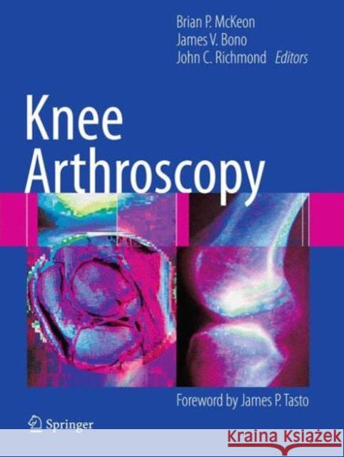 Knee Arthroscopy  9781461410553 Springer, Berlin - książka