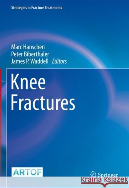 Knee Fractures Marc Hanschen Peter Biberthaler James P. Waddell 9783030817756 Springer - książka