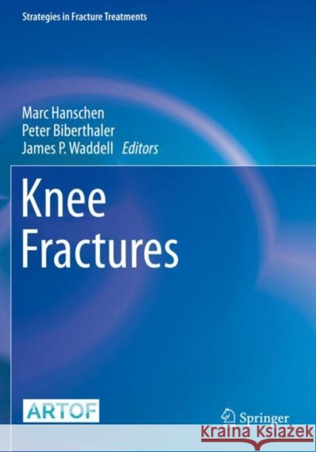 Knee Fractures Marc Hanschen Peter Biberthaler James P. Waddell 9783030817787 Springer - książka