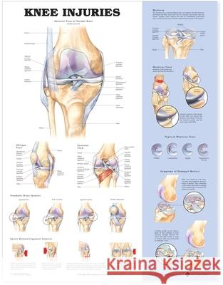 Knee Injuries Anatomical Chart   9781587797576  - książka